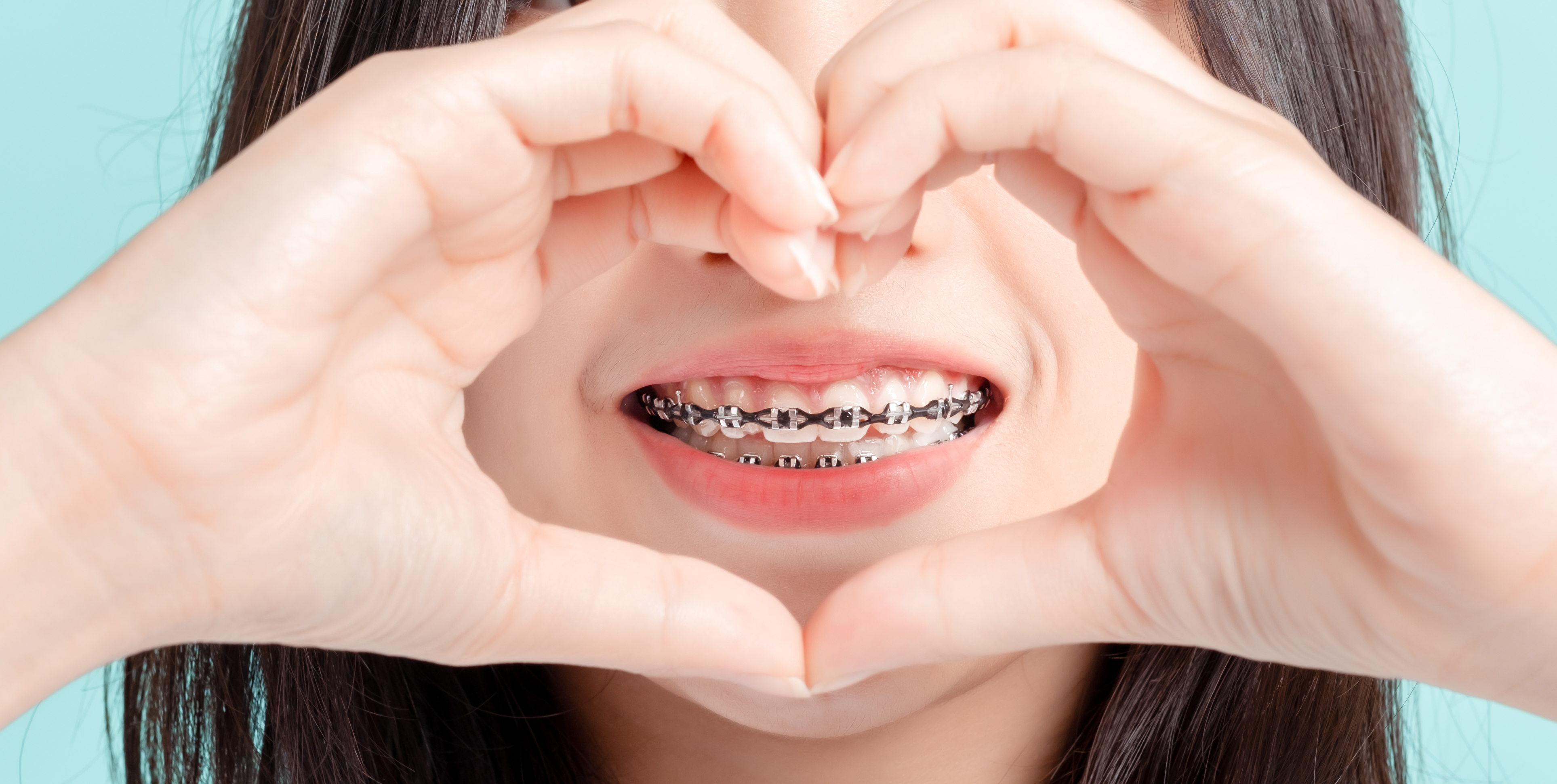 Phase II Orthodontics in Monsey