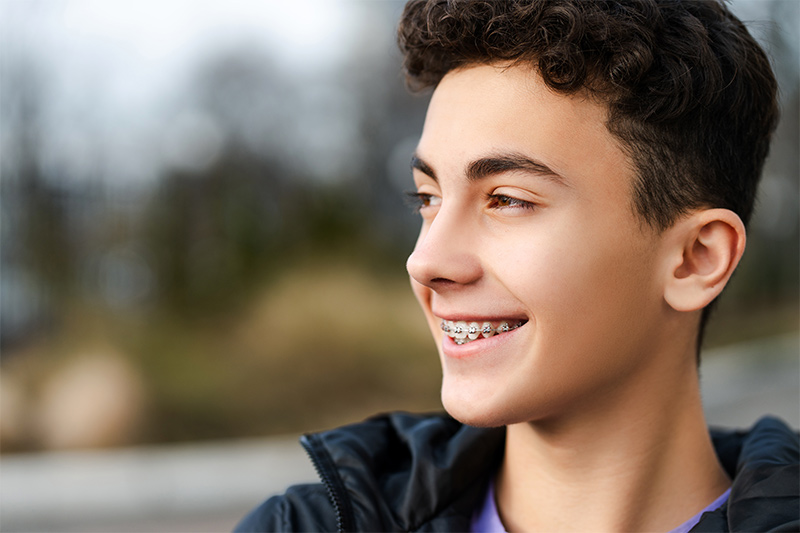 Braces