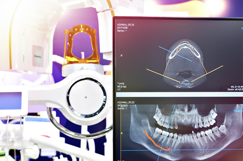 Digital X-Rays in Monsey