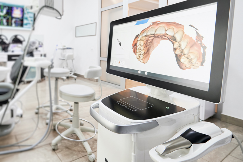 Intra-Oral Scanner in Monsey